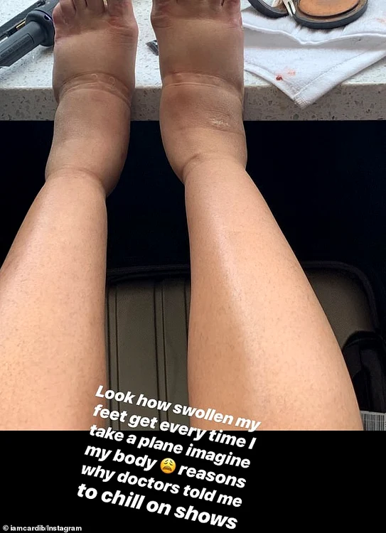 Aşa arată picioarele lui Cardi B după un zbor îndelungat cu avionul 