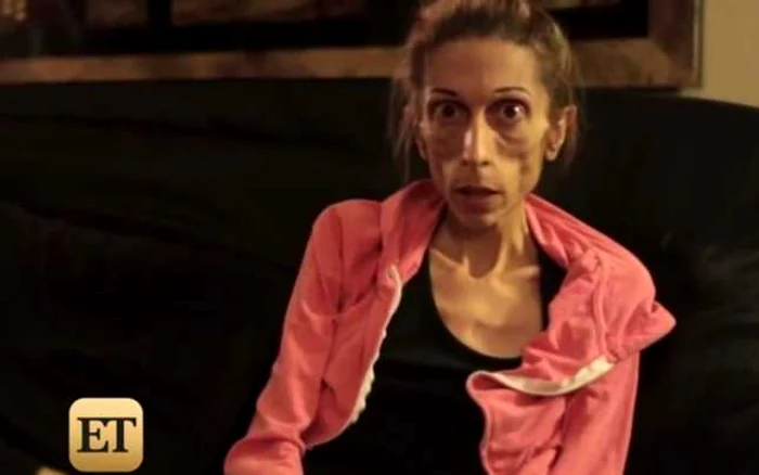 Rachael Farrokh cântăreşte numai 20 de kg şi este la un pas de moarte