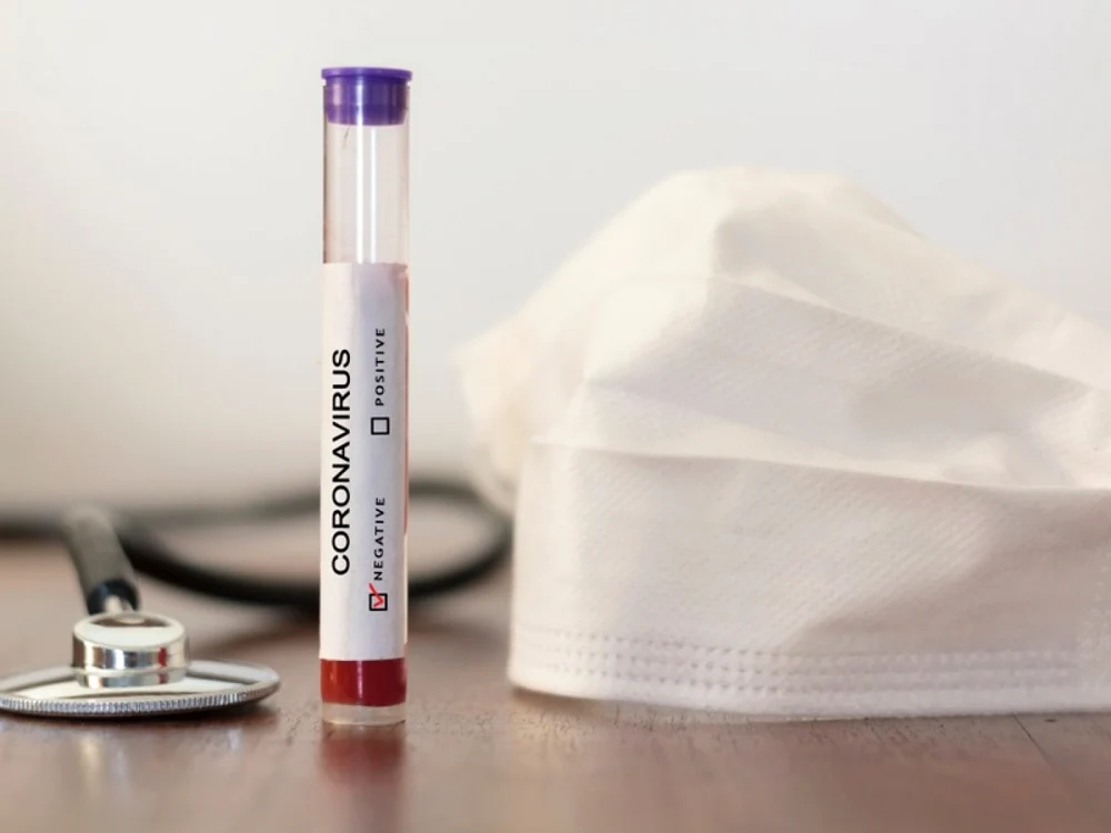 TAROM: în cazul în care pasagerii nu prezintă un Test Negativ Antigen COVID-19, accesul le este restricţionat. Foto: pharmaceutical-technology com