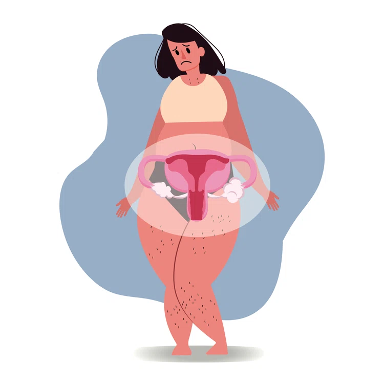 Boala dă simptome care le conduc pe femei la medic FOTO: Shutterstock