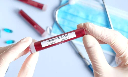 COVID 19/ Măsurile luate de mai multe state europene pentru a limita răspândirea coronavirusului  jpeg