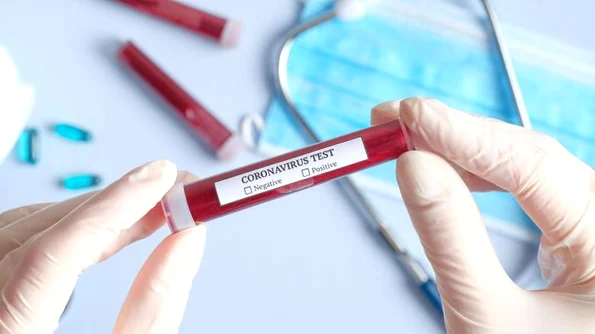 COVID 19/ Măsurile luate de mai multe state europene pentru a limita răspândirea coronavirusului jpeg