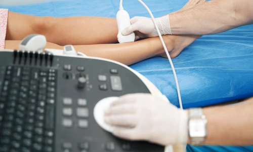 doppler ecografie jpg