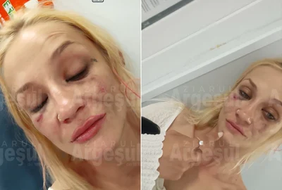 Video Mărturia pasagerei încătușate după bătaia într-un autobuz din Pitești: „Am 38 de kg, nu am vrut să mă bat cu șoferul!” FOTO Ziarul Argeșului 