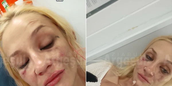 Video Mărturia pasagerei încătușate după bătaia într-un autobuz din Pitești: „Am 38 de kg, nu am vrut să mă bat cu șoferul!” FOTO Ziarul Argeșului 