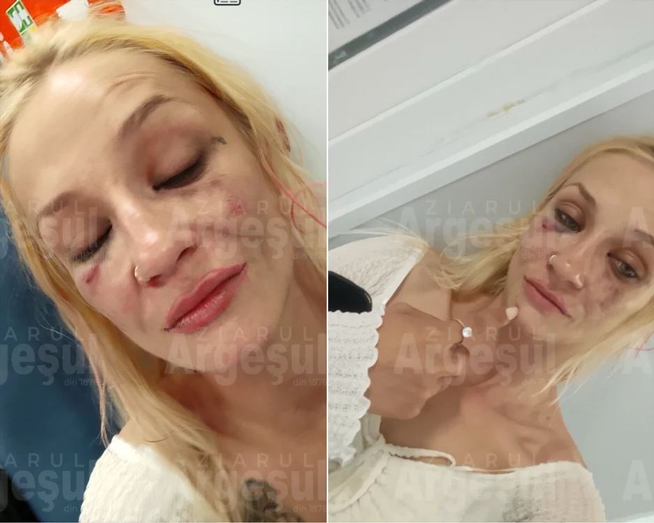 Femeia este acum la spital. FOTO: ziarulargesul.ro