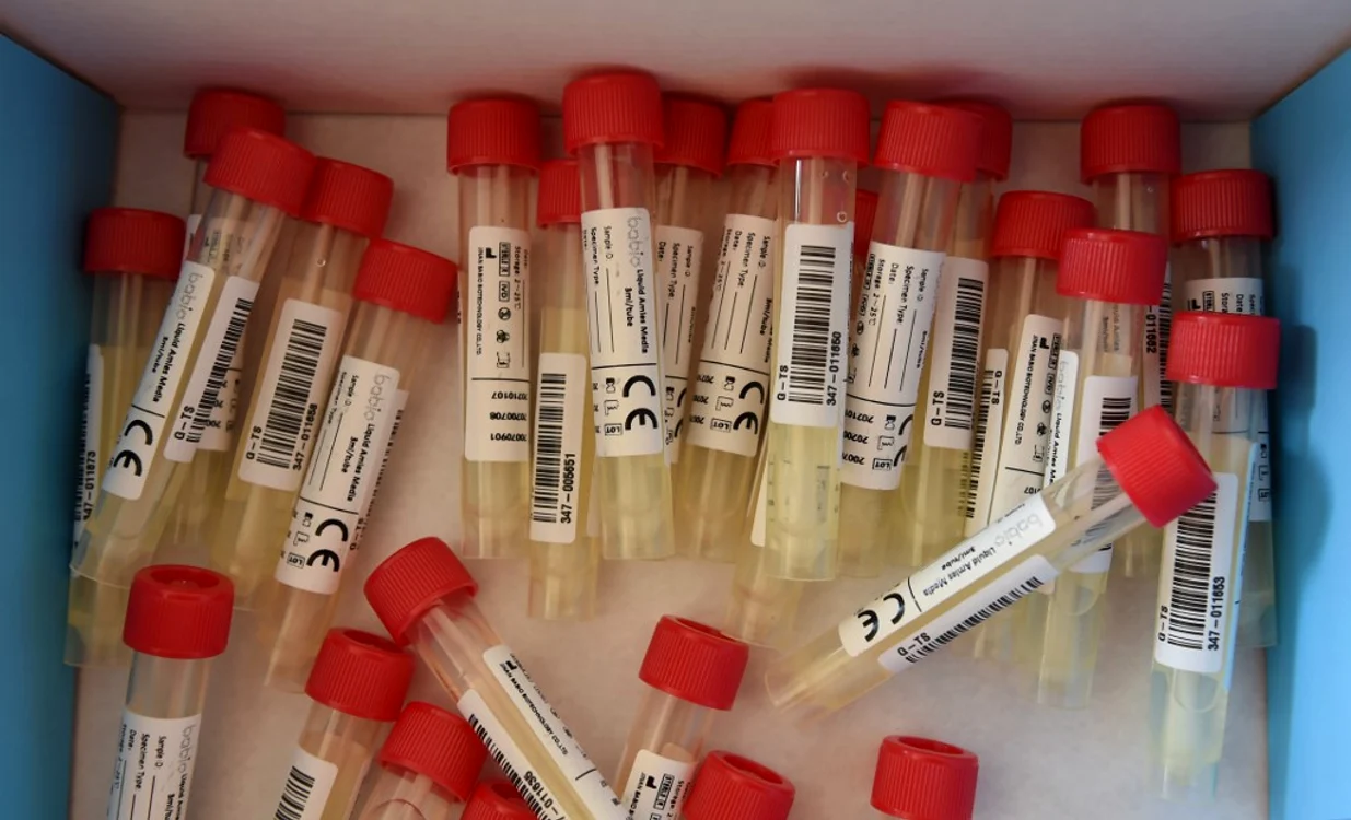 
    Toţi sunt asimptomatici, fiind monitorizaţi de către un medicfoto: AFP  