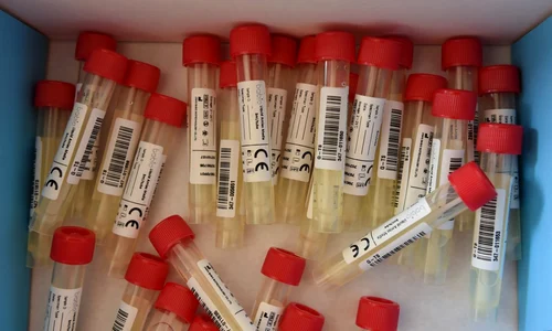 romani coronavirus jpeg