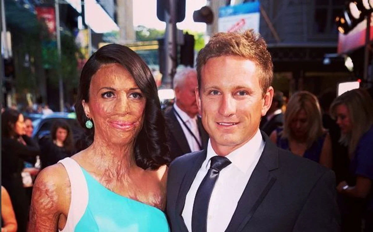 
    Turia Pitt şi Michael s-au logodit în 2015, iar bărbatul a renunţat la job pentru a o îngrijiFoto: Arhiva personală  