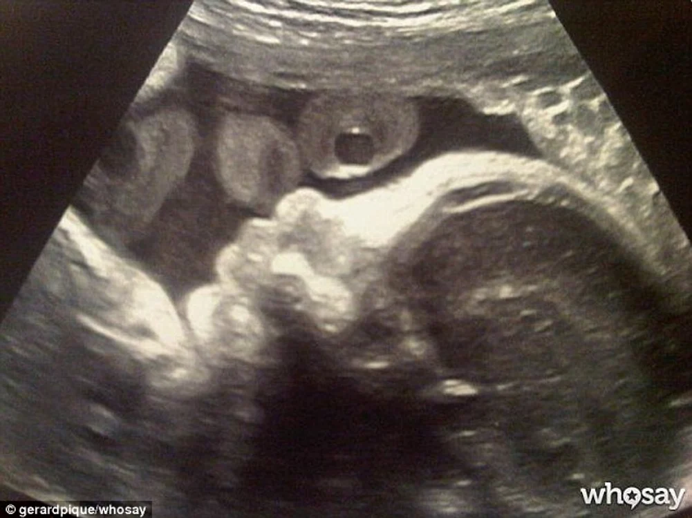 Prima imagine de ecograf cu copilul Shakirei (FOTO Daily Mail)