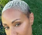 Jada Pinkett Smith suferă de alopecie