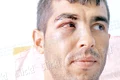 Agentul se află  acum la spital,  însă este în afara  oricărui pericol (foto: Ionuţ Dima) jpeg