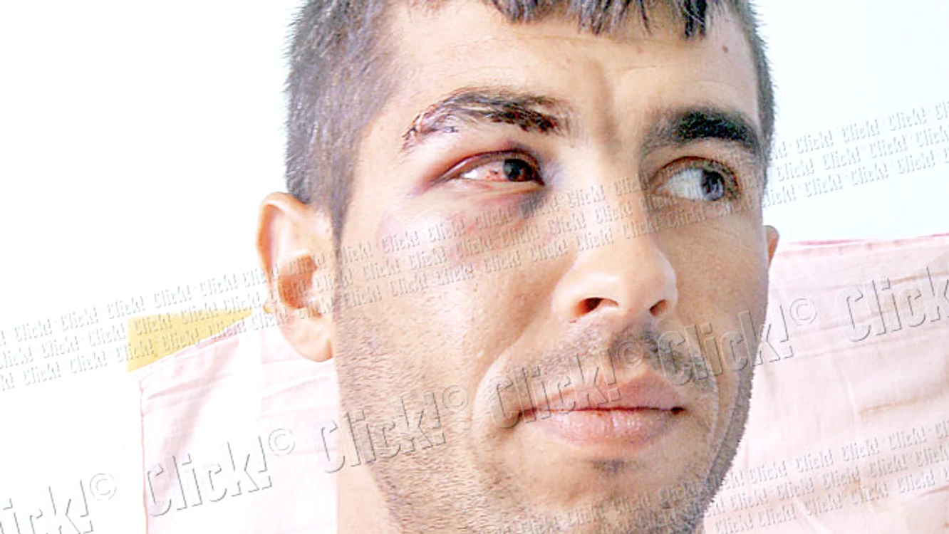 Agentul se află  acum la spital,  însă este în afara  oricărui pericol (foto: Ionuţ Dima)