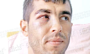 Agentul se află  acum la spital,  însă este în afara  oricărui pericol (foto: Ionuţ Dima) jpeg