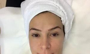 roxana ciuhulescu interventie estetica sani jpeg