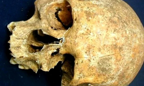 Oseminte din anii 500 indică existenţa operaţiilor pe creier jpeg