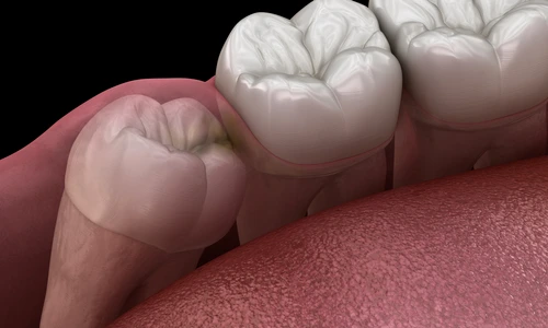 1 shutterstock 1254136165 jpg jpeg