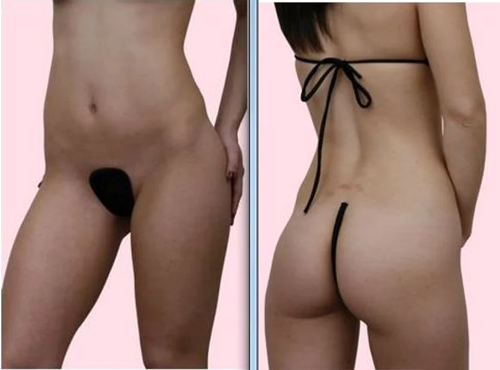 
    Prima care a purtat bikini a fost Micheline Bernardini, o dansatoare de cazinou  