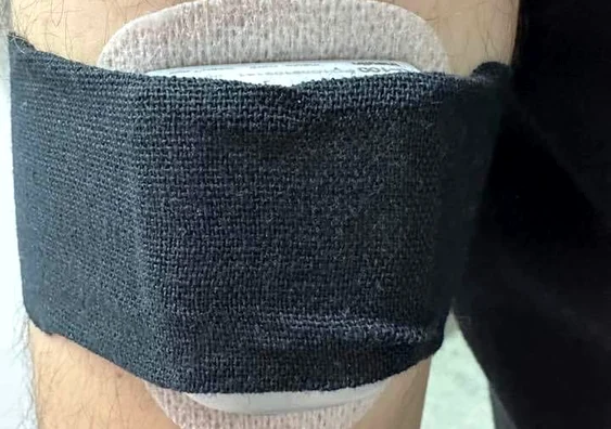 Pompă de insulină montată unui tânăr de către dr. Anca Nicoară. FOTO Facebook