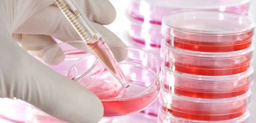 Testul de sânge identifică particulele de ADN afectate de cancer