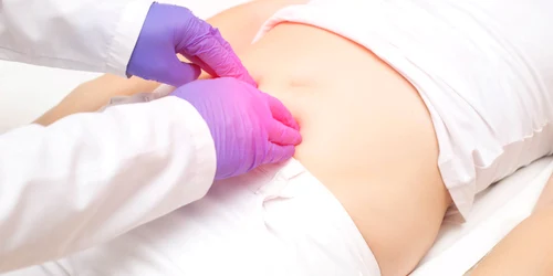 incontinenta urinara ginecologie SANADOR jpg